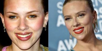 دندان ‌های ما در سال 2045 چه شکلی خواهند بود