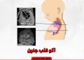 سلامت قلب از دوران جنینی: نقش اکوی قلب جنین و اهمیت مراجعه به فوق تخصص قلب کودکان 11 اکو قلب جنین اوسط دکتر رضا مسیحی