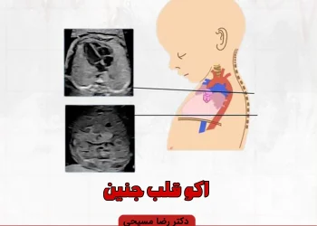اکو قلب جنین اوسط دکتر رضا مسیحی