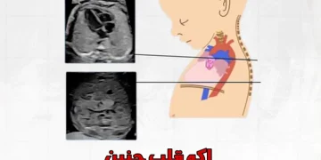 اکو قلب جنین اوسط دکتر رضا مسیحی