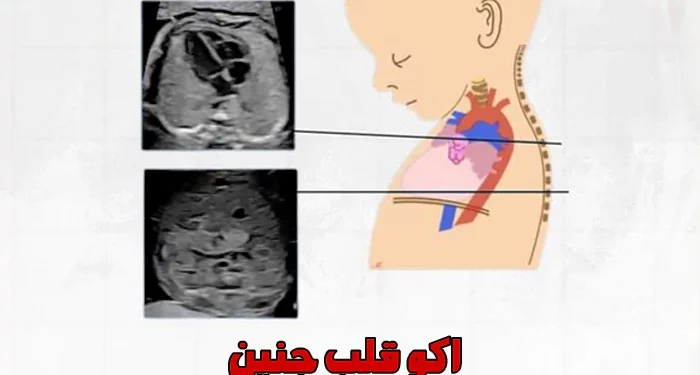 سلامت قلب از دوران جنینی: نقش اکوی قلب جنین و اهمیت مراجعه به فوق تخصص قلب کودکان 1 اکو قلب جنین اوسط دکتر رضا مسیحی