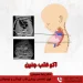 سلامت قلب از دوران جنینی: نقش اکوی قلب جنین و اهمیت مراجعه به فوق تخصص قلب کودکان 7 اکو قلب جنین اوسط دکتر رضا مسیحی