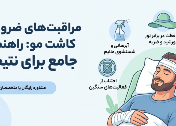 بعد از کاشت مو چه مراقبتهایی ضروری است؟ 16 مراقبت های ضروری بعد از کاشت مو