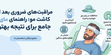 مراقبت های ضروری بعد از کاشت مو