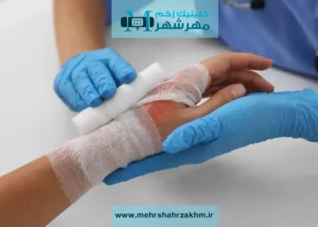 تغییر رنگ در زخم