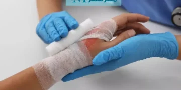 تغییر رنگ در زخم