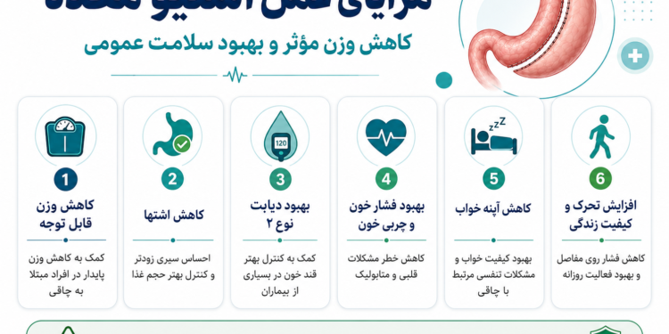 عمل اسلیو معده چگونه انجام میشود؟ 1 اسلیو معده