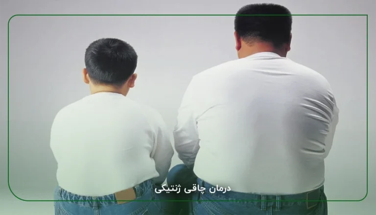 مراقبت های تغذیه ای بعد از بوتاکس معده برای تثبیت وزن 81 درمان چاقی ژنتیکی