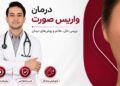 درمان واریس صورت در تهران؛ بررسی تخصصی و روشهای درمان در کلینیک ایران واریس 45 درمان واریس صورت
