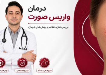 درمان واریس صورت در تهران؛ بررسی تخصصی و روشهای درمان در کلینیک ایران واریس 31 درمان واریس صورت