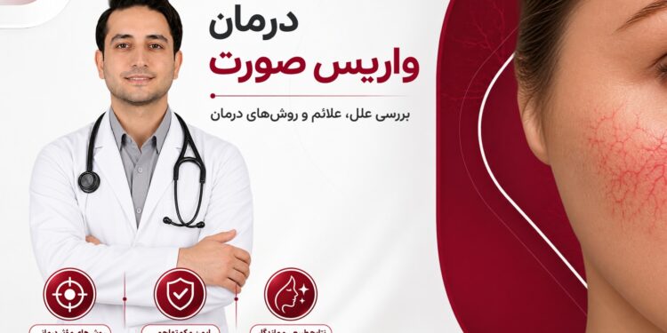 درمان واریس صورت در تهران؛ بررسی تخصصی و روشهای درمان در کلینیک ایران واریس 1 درمان واریس صورت